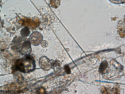 phyto/Scattered_Islands/all/COMMA April 2011/Polykrikos sp (ancien Dino n- Gymnodiniales cf Polykrikos ou Warnowia)(copy)_thumb.jpg